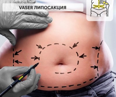 ��� ����� ������������� �������������� ���������� � ������������